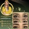 میکروبلیدینگ در بهترین مرکز میکرو