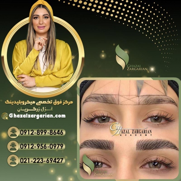 فیبروز ابرو به صورت تخصصی