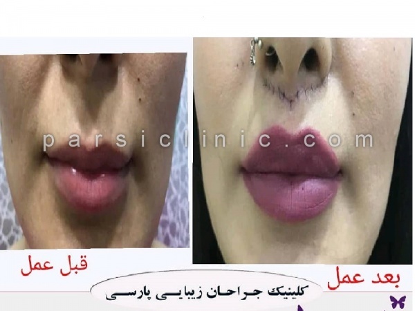 کلینیک جراحی زیبایی نیاوران