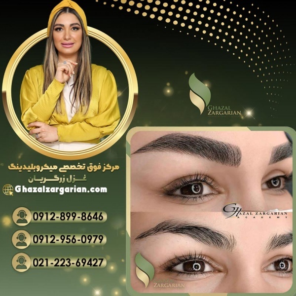 جدیدترین روش فیبروز در آکادمی غزل زرگریان