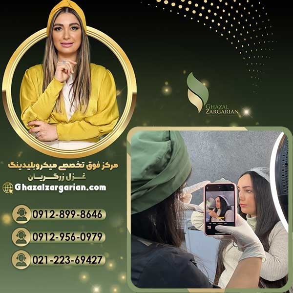 بهترین مرکز ریموو ابرو در تهران و ایران
